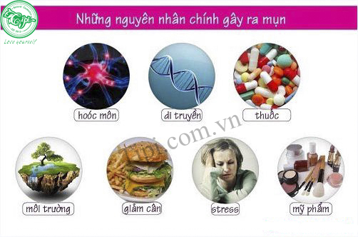 Một số nguyên nhân gây mụn thường gặp