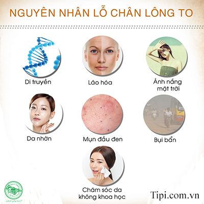 Một số nguyên nhân khiến lỗ chân lông to