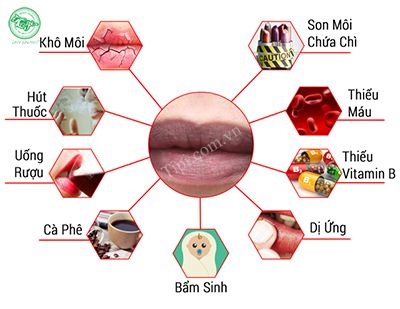 Những nguyên nhân gây thâm môi thường gặp